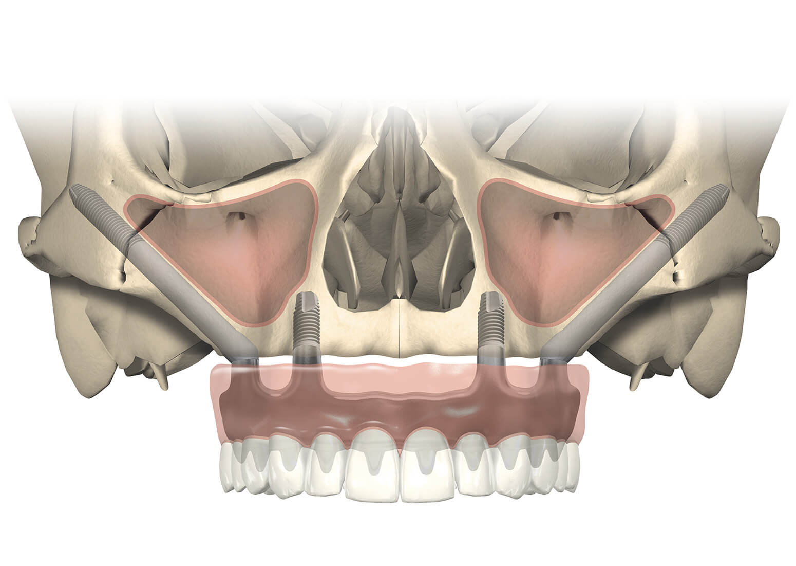 zygoma