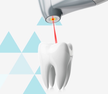 Dental Laser