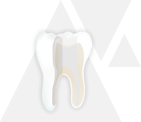 endodontie step 6